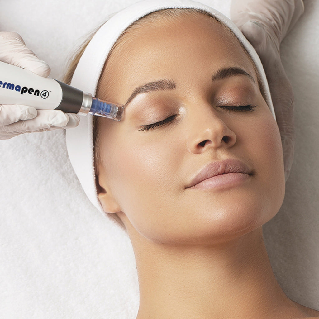 Skin Needling, Your Ultimate Winter Skin Saviour